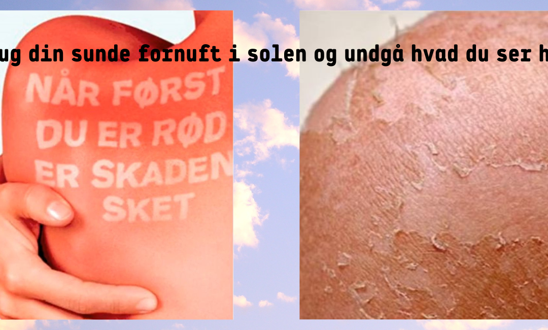 hudkræft