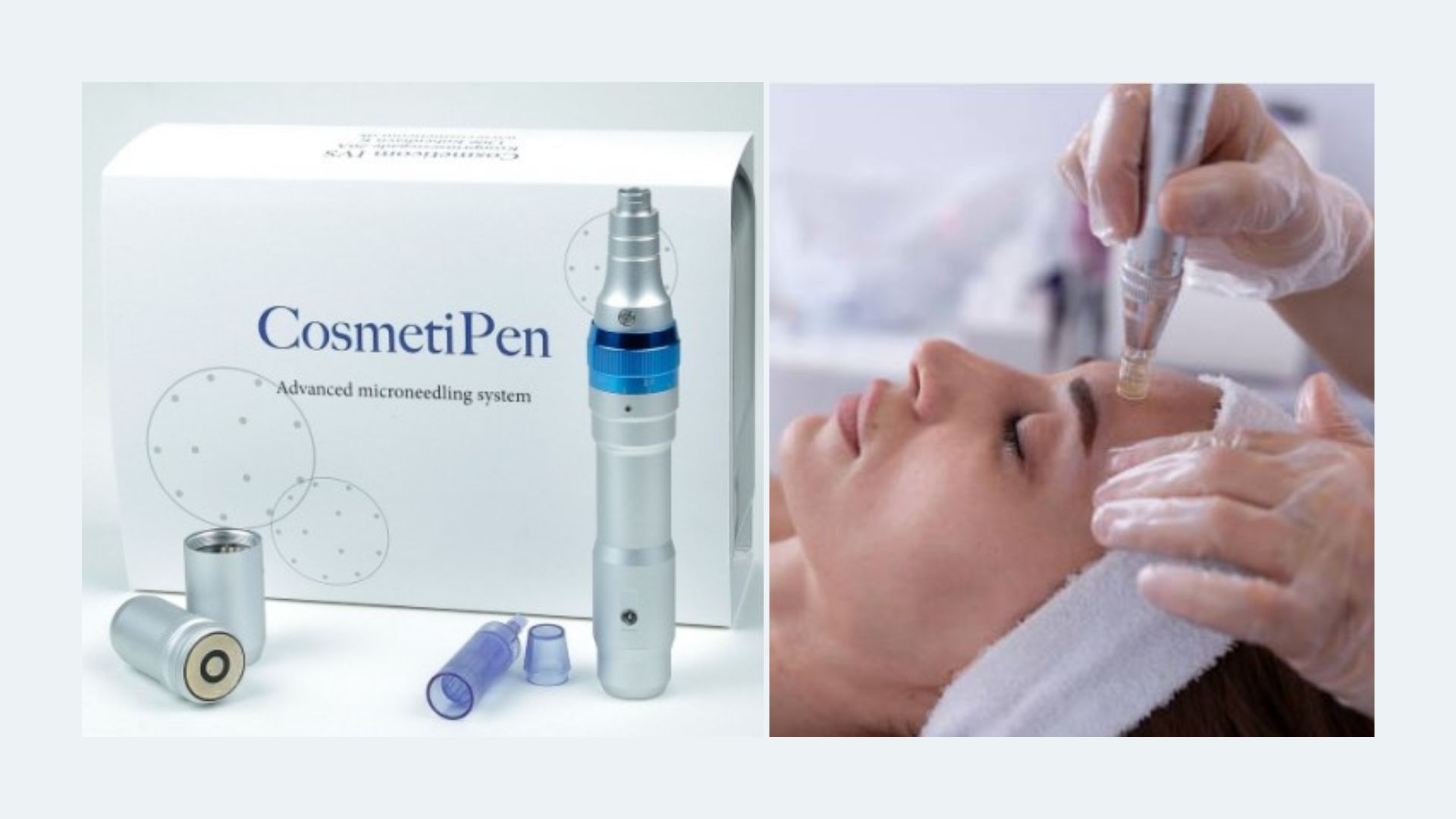 Skin pen micro peeling